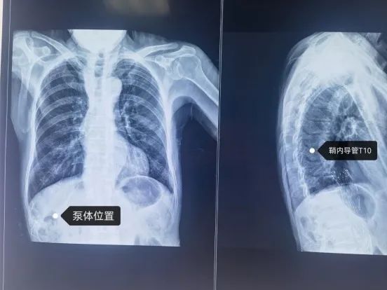 1641864779185067.png 图片