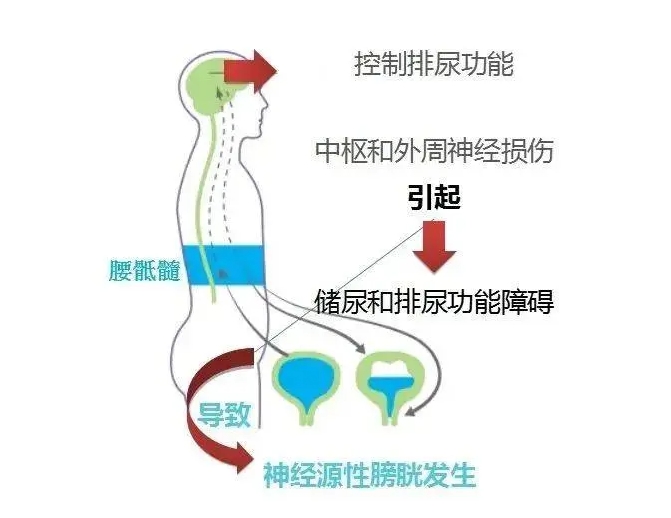 微信截图_20250321171445.png